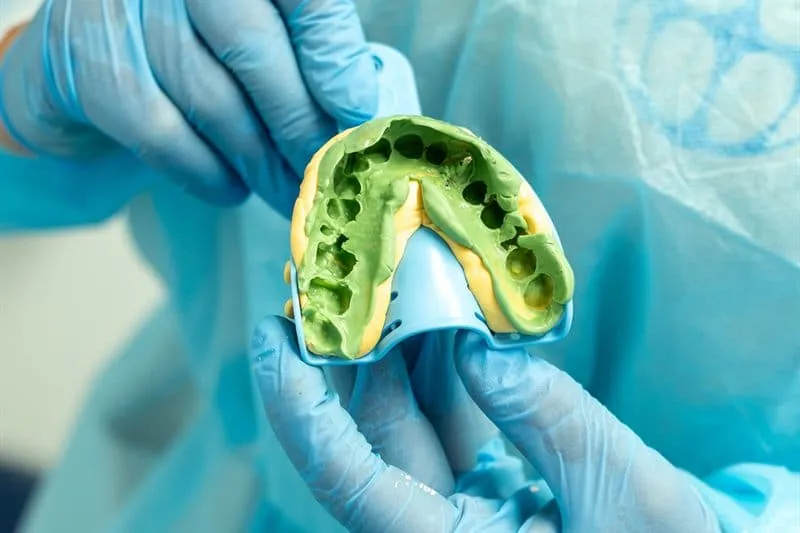 Profesional de las Clínicas Dentales Francisco Hernández Vallejo sosteniendo un molde dental con guantes